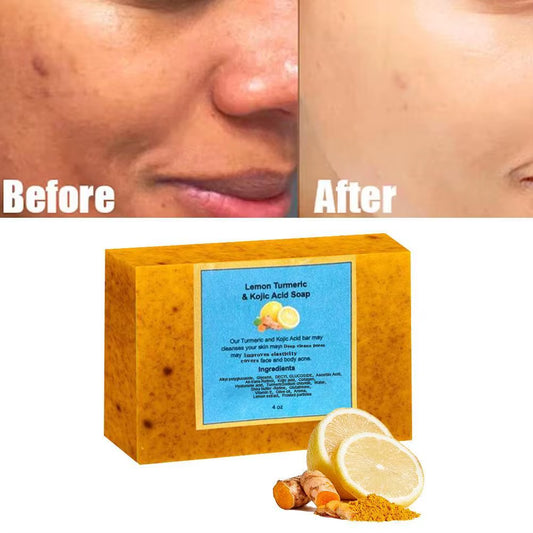 Turmeric Lemon Soap Bar for Face Body Tumeric Soap Smooth Skin Cleansing Natural Handmade Soap Skin Formula Soap for Women