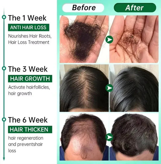 Hair Growth Serum